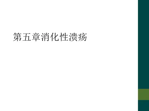 第五章消化性溃疡