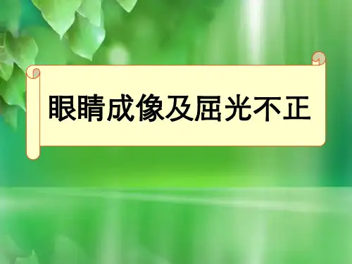 眼睛成像及屈光不正