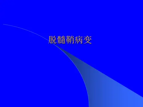 【影像诊断课件】脱髓鞘病变