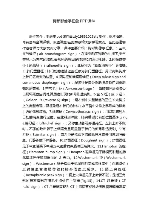 胸部影像学征象PPT课件