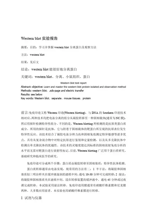 免疫印迹实验报告——wester-blot