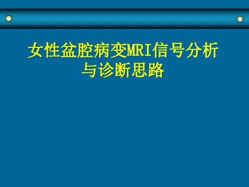 【医学PPT课件】女性盆腔病变MRI信号分析与诊断思路PPT