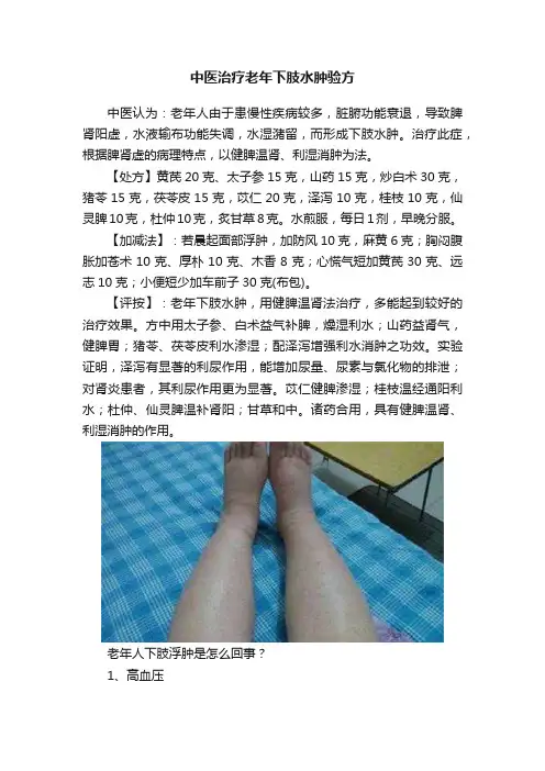 中医治疗老年下肢水肿验方