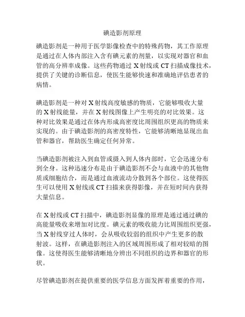 碘造影剂原理