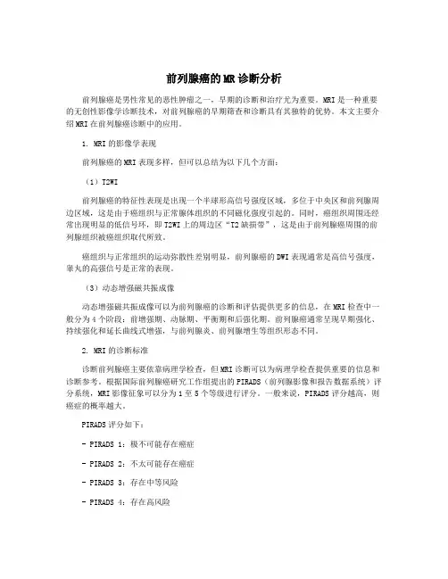 前列腺癌的MR诊断分析