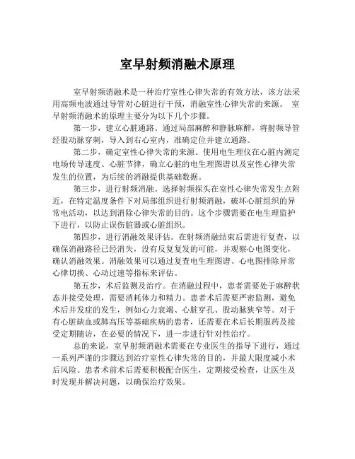 室早射频消融术原理