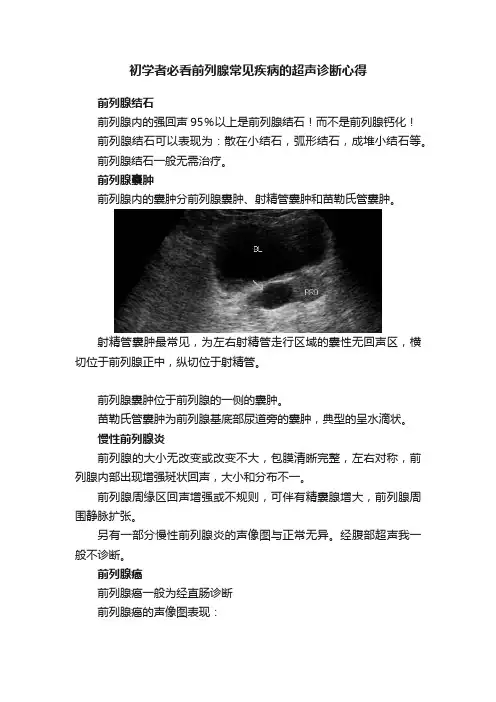 初学者必看前列腺常见疾病的超声诊断心得
