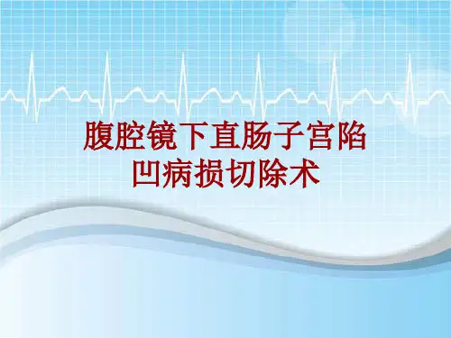 手术讲解模板：腹腔镜下直肠子宫陷凹病损切除术