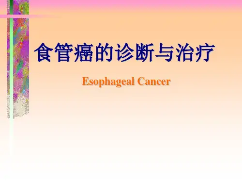 规培课件—食管癌的诊断与治疗