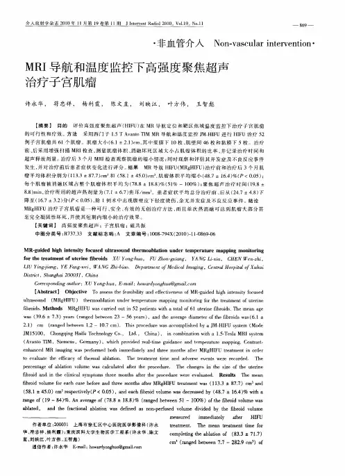 MRI导航和温度监控下高强度聚焦超声治疗子宫肌瘤