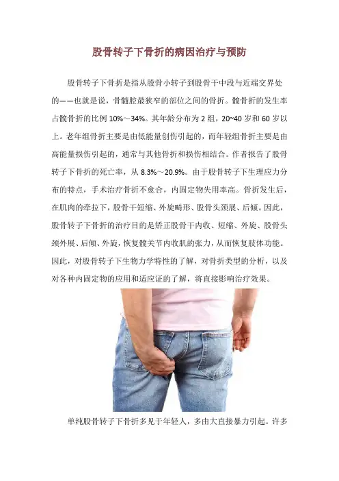 股骨转子下骨折的病因治疗与预防