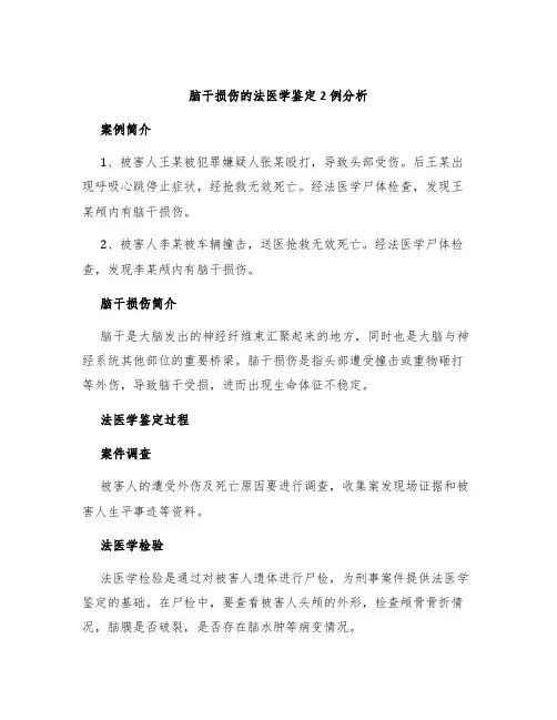 脑干损伤的法医学鉴定2例分析