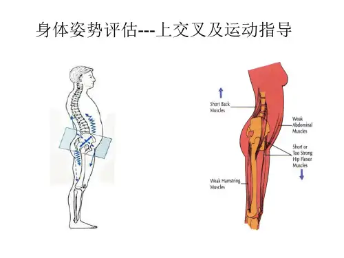 姿态评估之上交叉综合征及运动指导