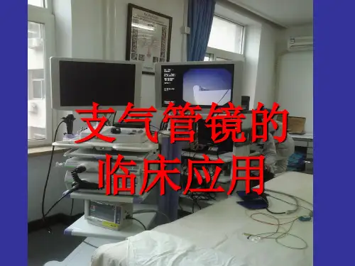 支气管镜临床应用