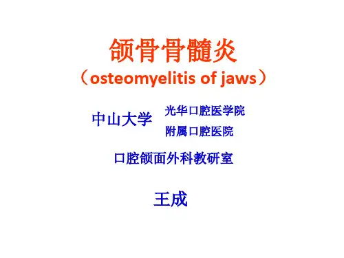 (口腔颌面外科)颌骨骨髓炎