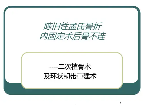 陈旧性孟氏骨折PPT课件