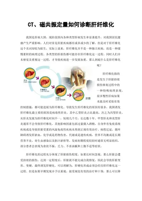 CT、磁共振定量如何诊断肝纤维化