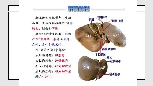 肝硬化上课PPT课件