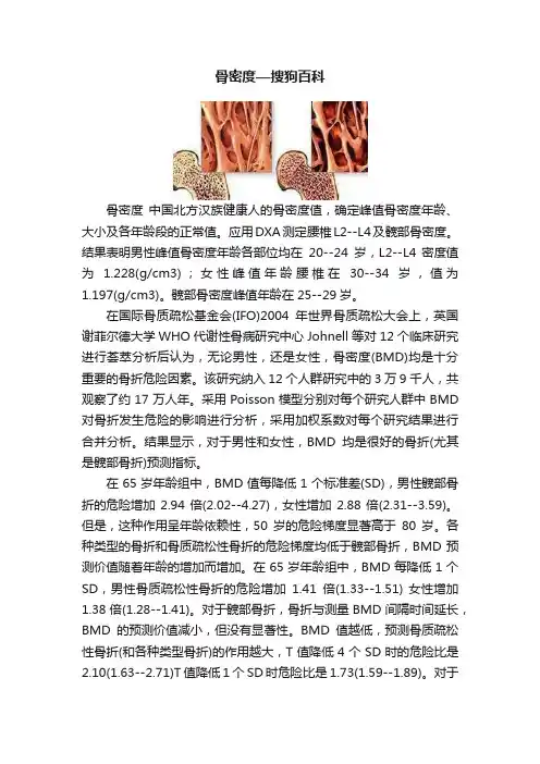 骨密度—搜狗百科