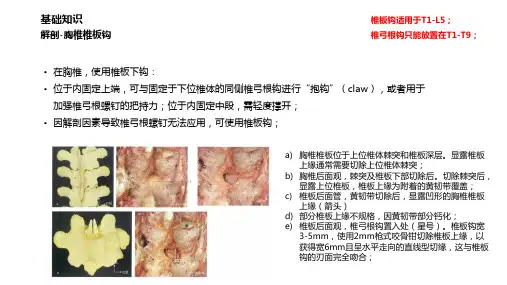 脊柱骨钩技术基础