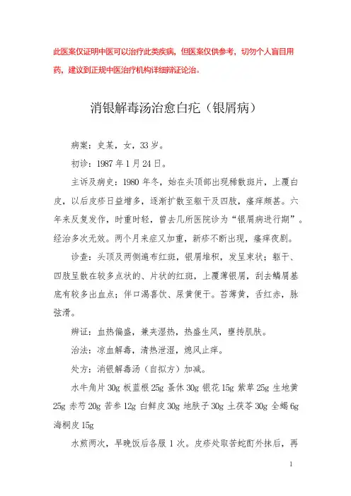 中医医案——银屑病