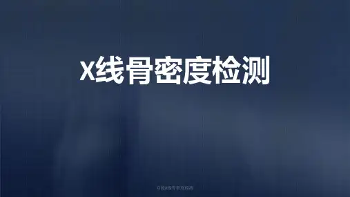 双能X线骨密度检测