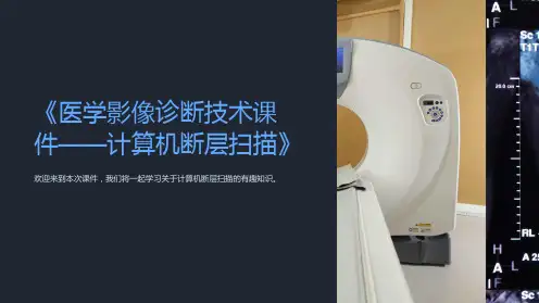 《医学影像诊断技术课件——计算机断层扫描》