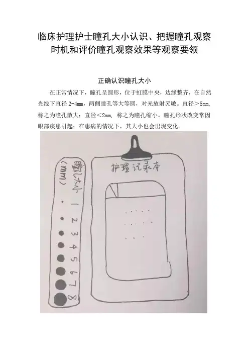 临床护理护士瞳孔大小认识、把握瞳孔观察时机和评价瞳孔观察效果等观察要领