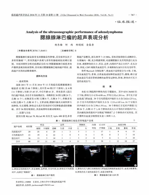 腮腺腺淋巴瘤的超声表现分析