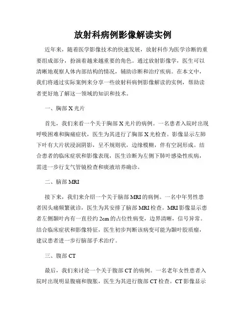 放射科病例影像解读实例