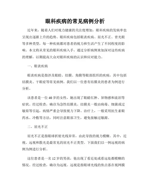 眼科疾病的常见病例分析
