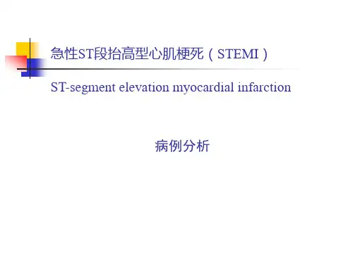 STEMI急性ST段抬高型心肌梗死