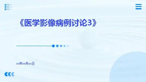 医学影像病例讨论3