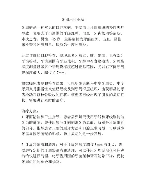 牙周出科小结