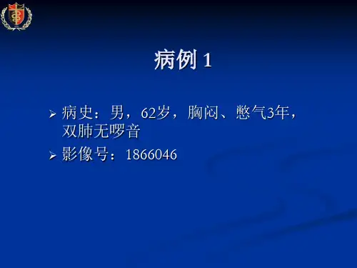 呼吸系统课件：胸腔积液