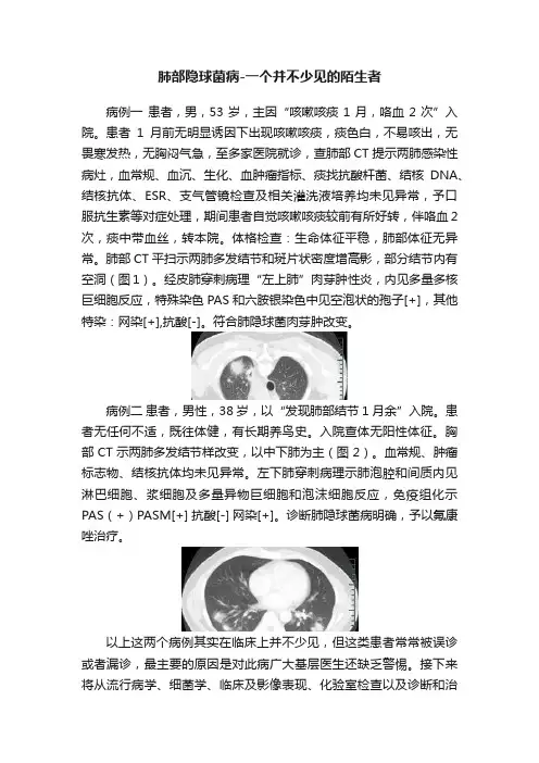 肺部隐球菌病-一个并不少见的陌生者