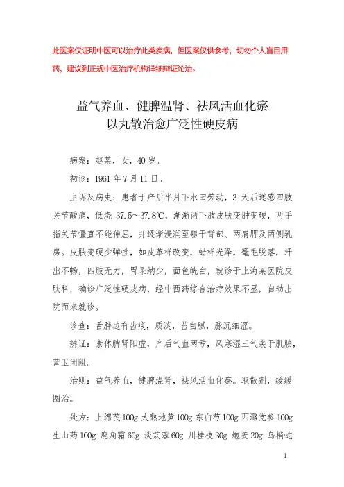 中医医案——广泛性硬皮病