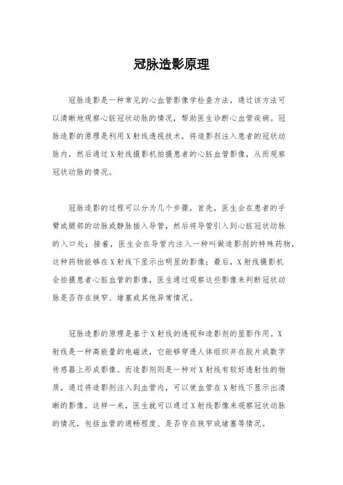 冠脉造影原理