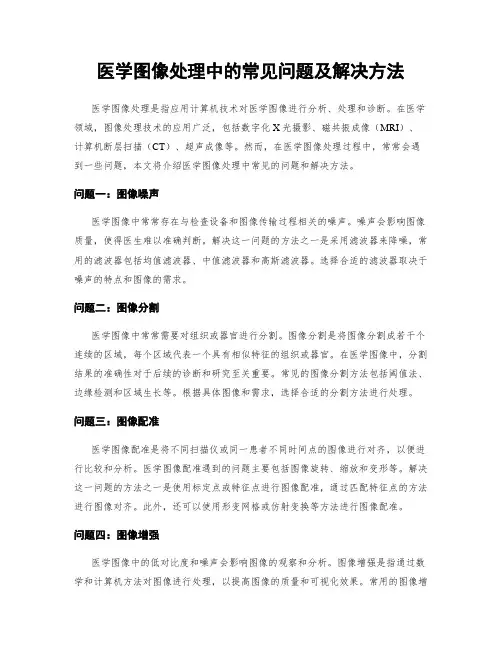 医学图像处理中的常见问题及解决方法