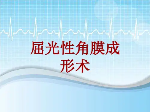 手术讲解模板：屈光性角膜成形术