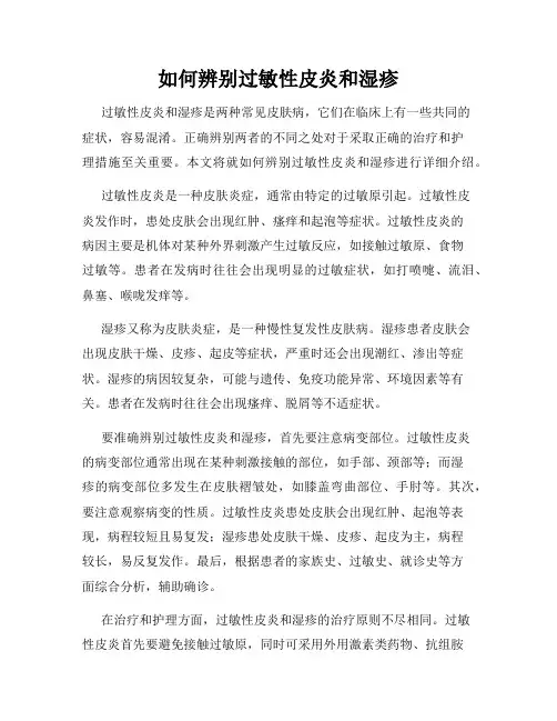 如何辨别过敏性皮炎和湿疹