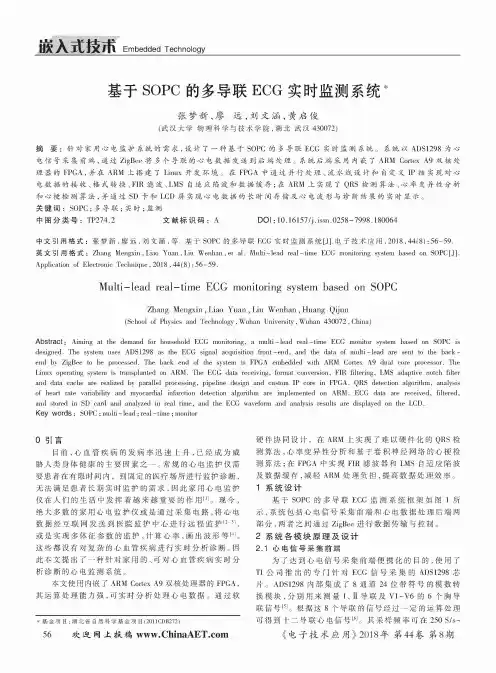 基于SOPC的多导联ECG实时监测系统