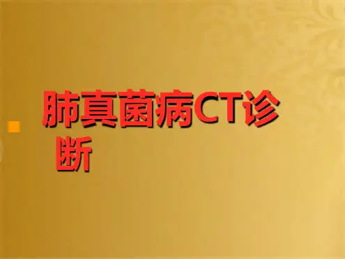 CT诊断肺真菌病(共48张PPT)