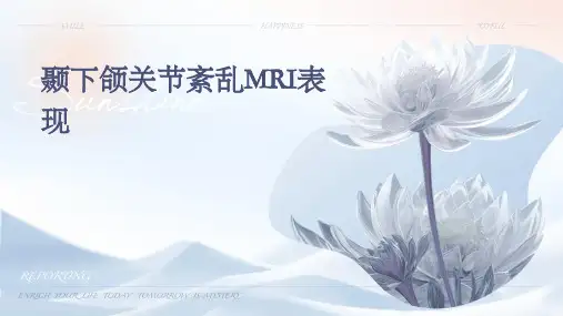 颞下颌关节紊乱MRI表现PPT