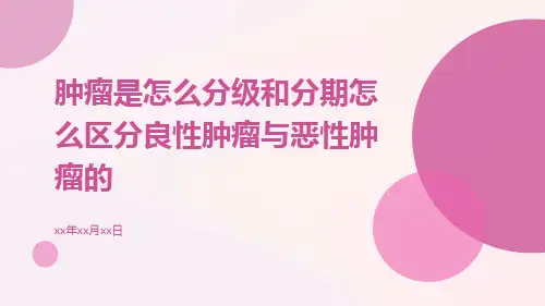 肿瘤是怎么分级和分期怎么区分良性肿瘤与恶性肿瘤的