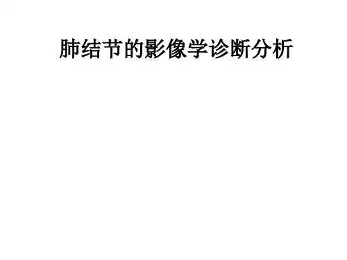 肺结节的影像学诊断分析报告