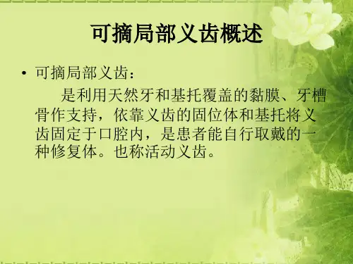 可摘局部义齿概述(必看)