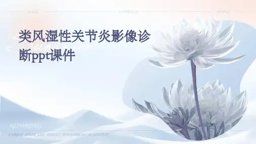 类风湿性关节炎影像诊断PPT课件