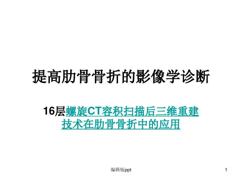 肋骨骨折的影像学诊断PPT课件