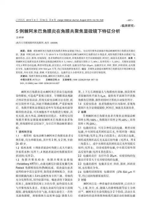 5例棘阿米巴角膜炎在角膜共聚焦显微镜下特征分析